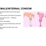 Contraception & Prevention of STI
